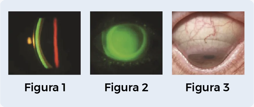Europa Scleral — logotipo